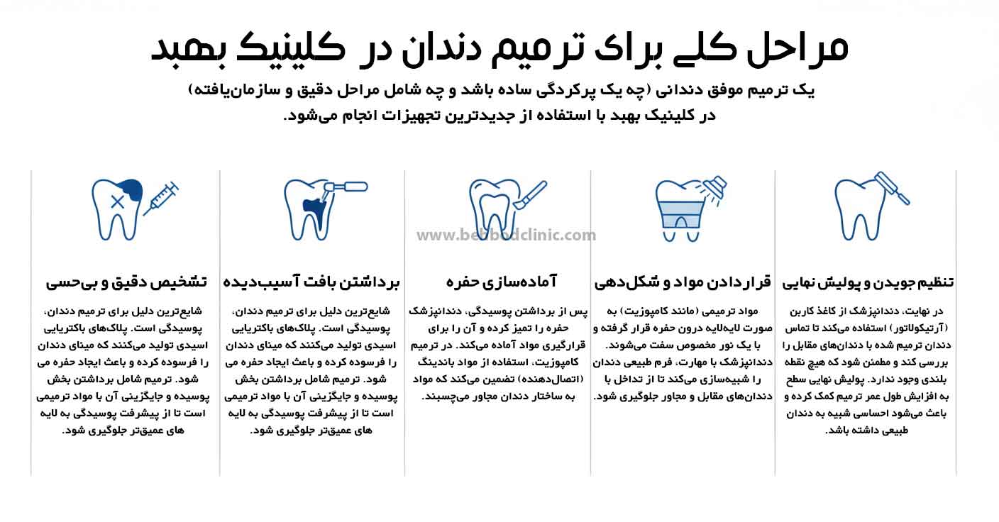 مراحل عمومی انجام ترمیم دندان در کلینیک بهبد