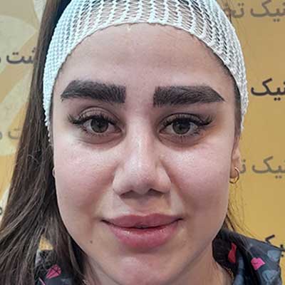 Circular slider image