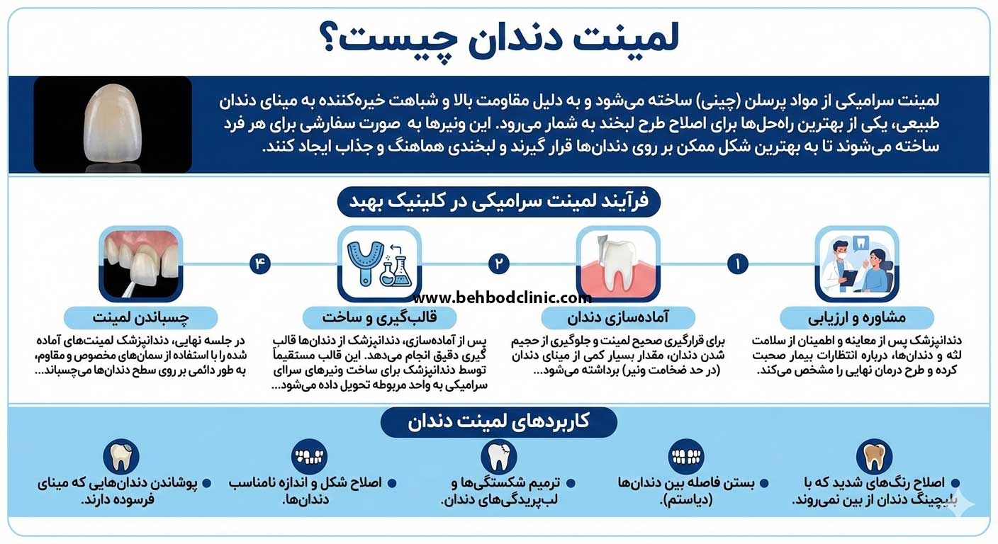 بلیچینگ دندان، لمینت و کامپوزیت