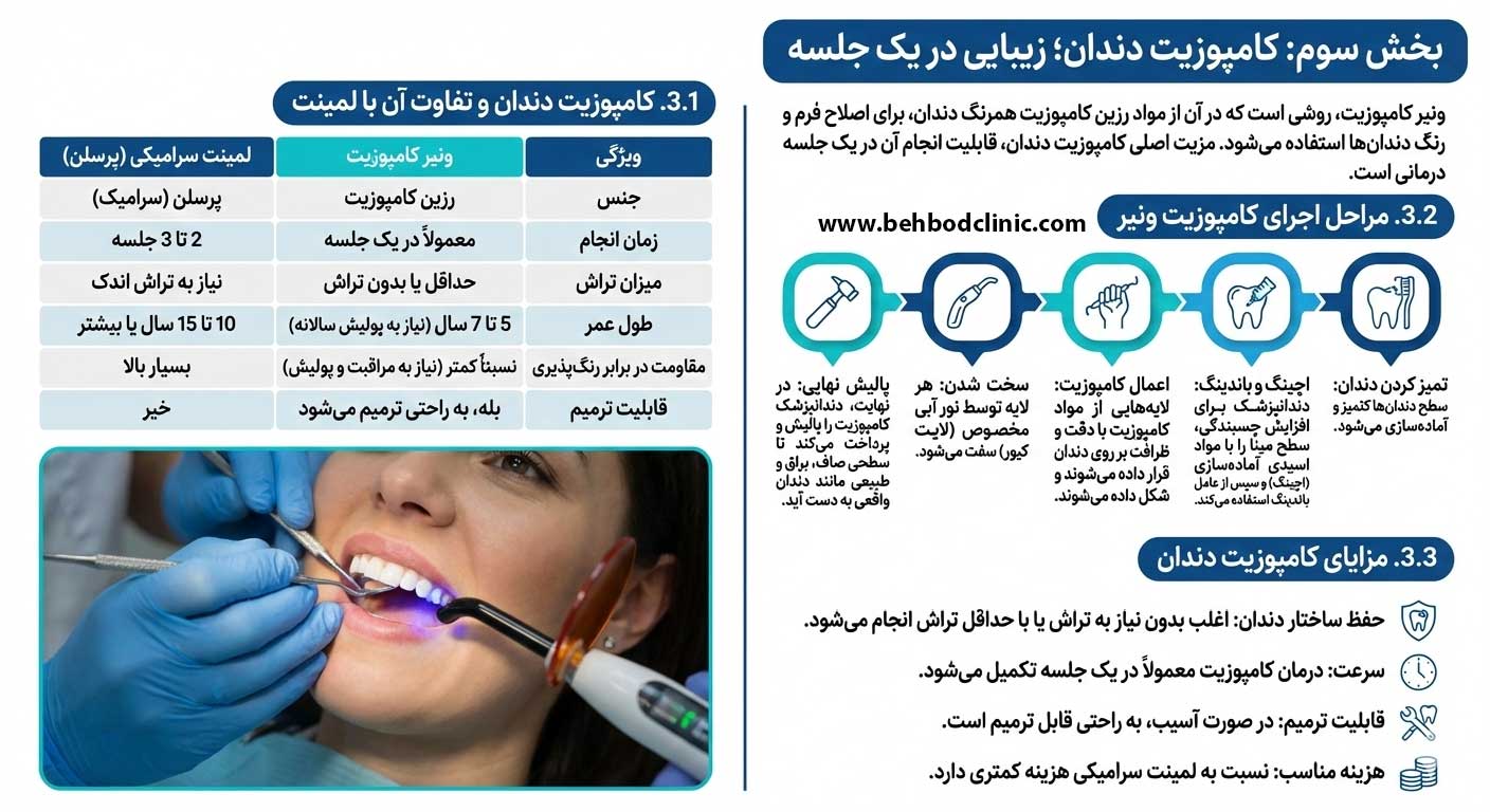بلیچینگ دندان، لمینت و کامپوزیت