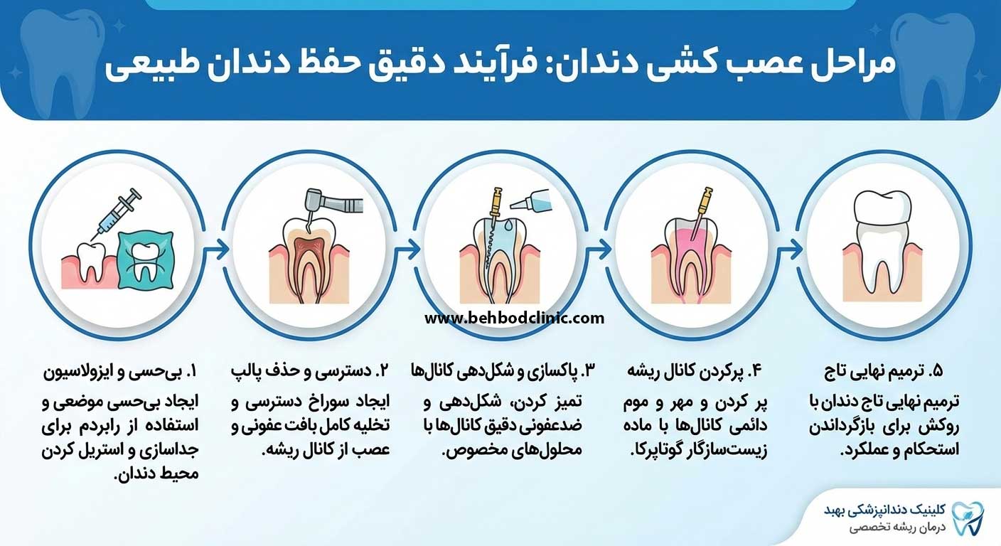 مراحل عصب کشی دندان