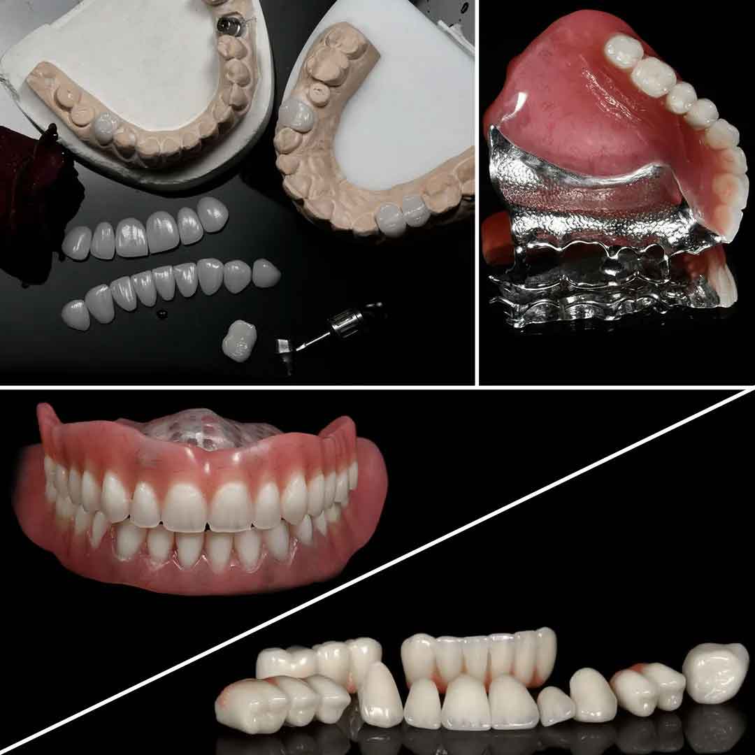 پروتز متحرک دندان